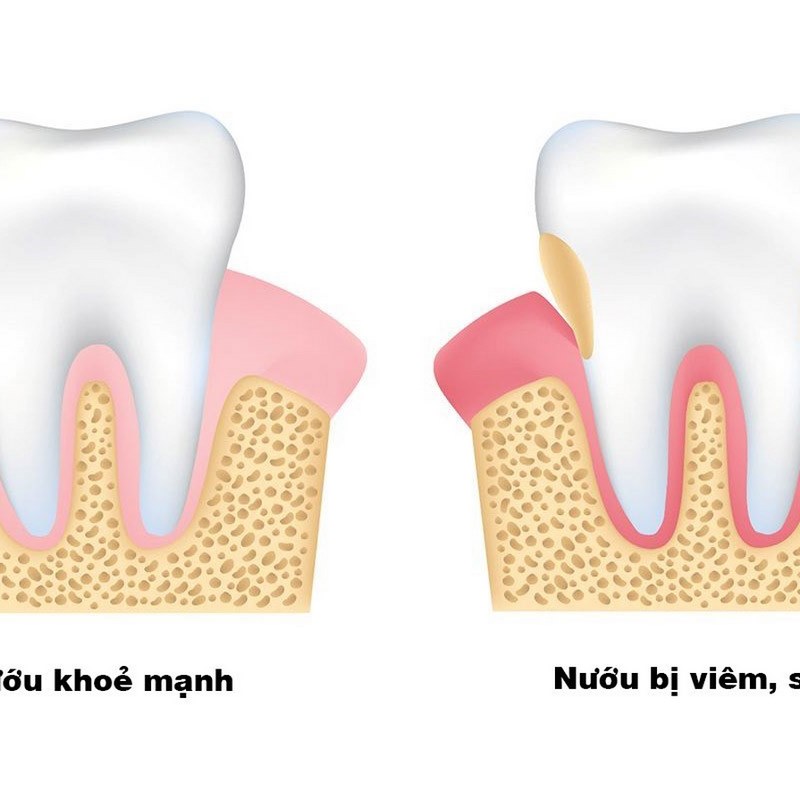 Bác sĩ sẽ điều tra về các triệu chứng mà bạn đang gặp phải