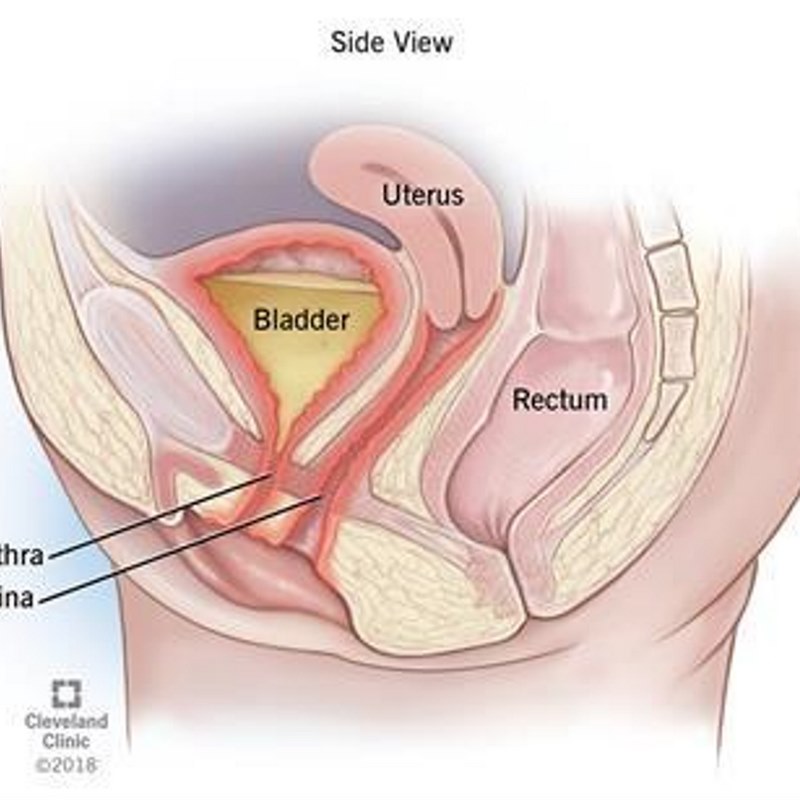 Người có tiểu tiện ảnh hưởng đến hệ thống tiểu đường hoặc tiểu buồn