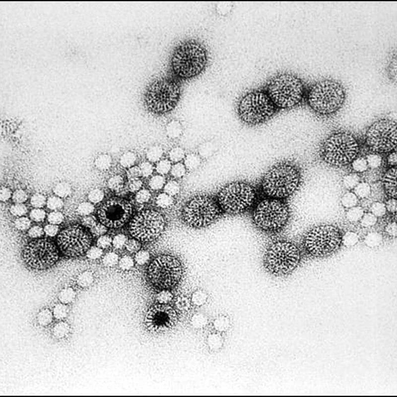 Mẫu phân sẽ được kiểm tra để phát hiện có virus Rota hay không