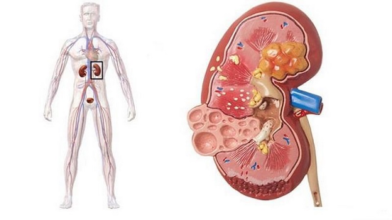 Thăm khám bệnh nhân để xác định các dấu hiệu và triệu chứng của bệnh