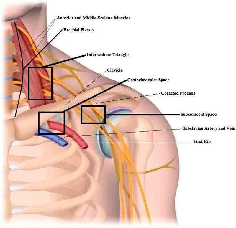 Các bài tập mạnh cơ cổ giúp hạn chế diễn tiến của hội chứng lối thoát ngực