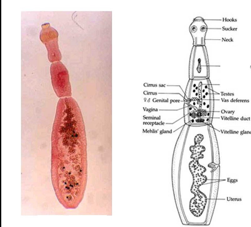 Những dấu hiệu và triệu chứng của Nhiễm Echinococcus