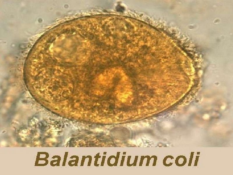 Balantidium là một loại ký sinh trùng đơn bào