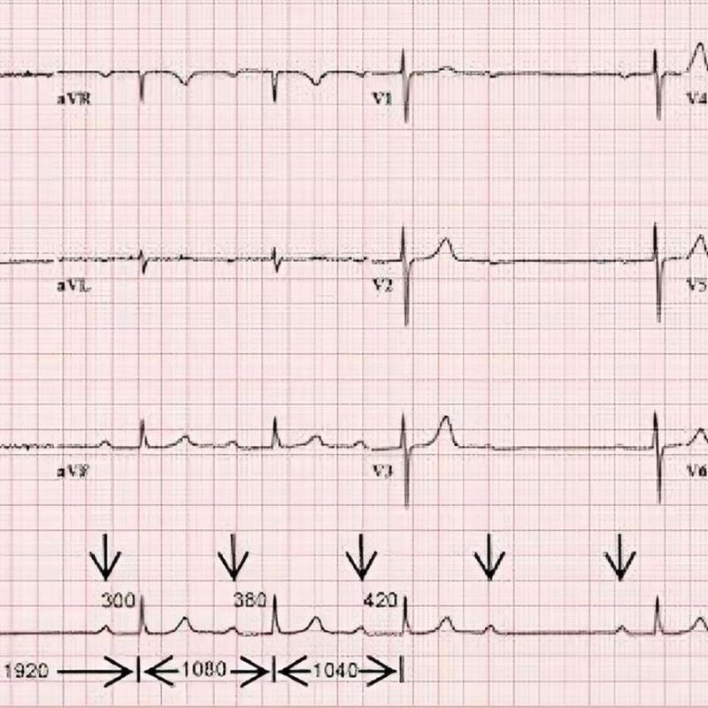 Sau khi đặt chẩn đoán, bác sĩ sẽ lên kế hoạch điều trị