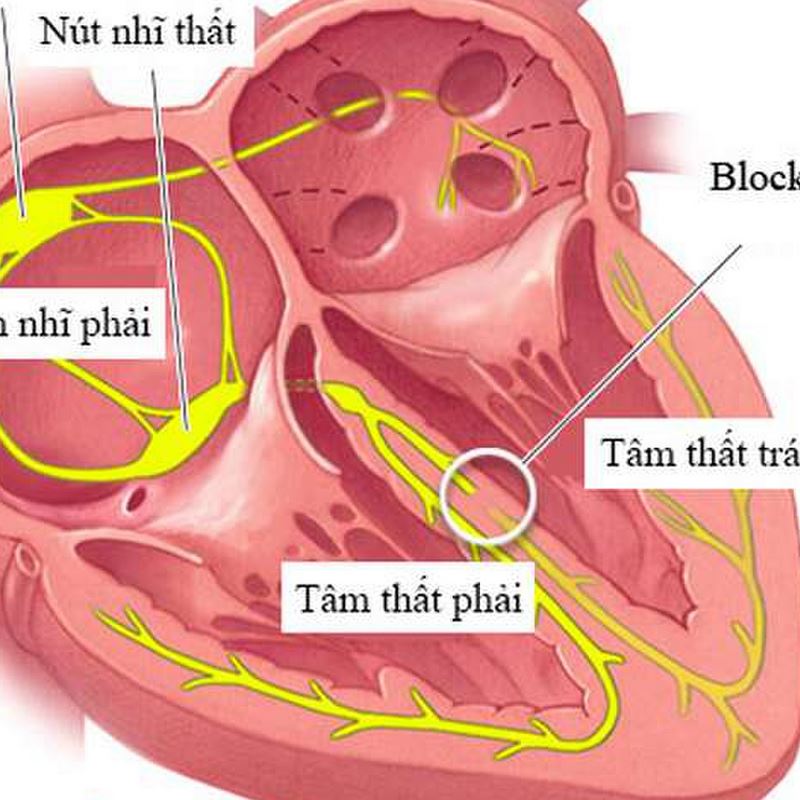 Người có tiền sử bệnh tim và động mạch và động mạch có nguy cơ mắc bệnh