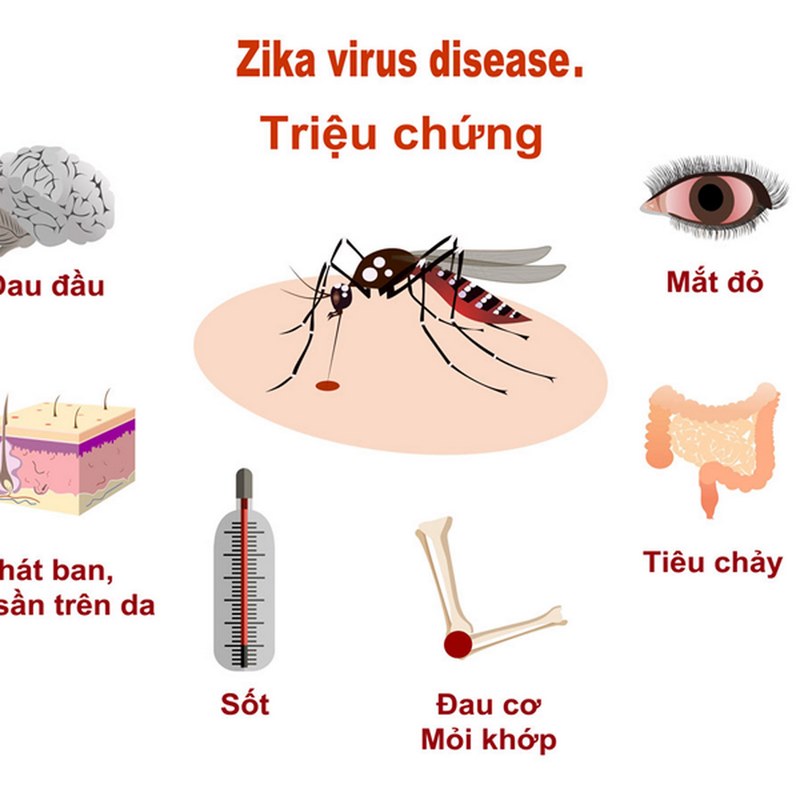 Người bị nhiễm vi rút Zika có nhiều triệu chứng