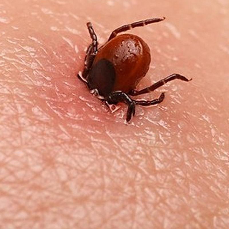 Bệnh Lyme là một bệnh truyền nhiễm do vi khuẩn gây ra