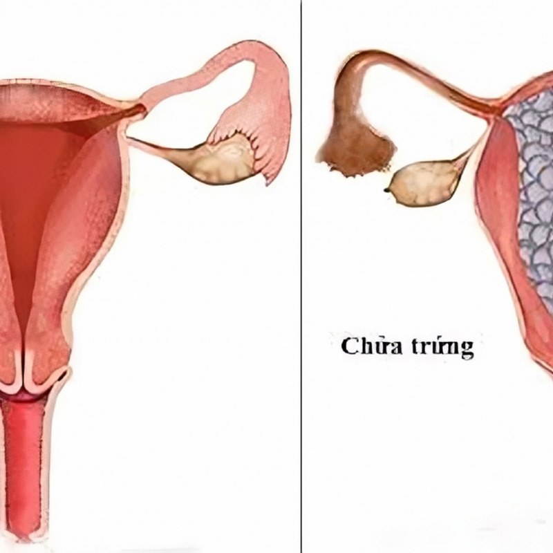 Một số dấu hiệu và triệu chứng thường gặp