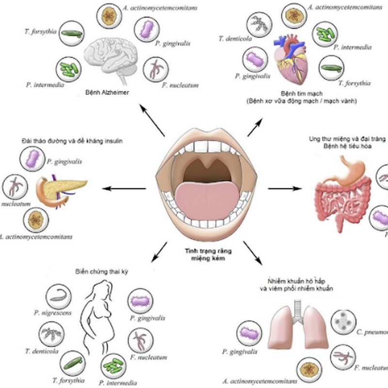 Một trong những triệu chứng phổ biến của bệnh nướu và nha chu