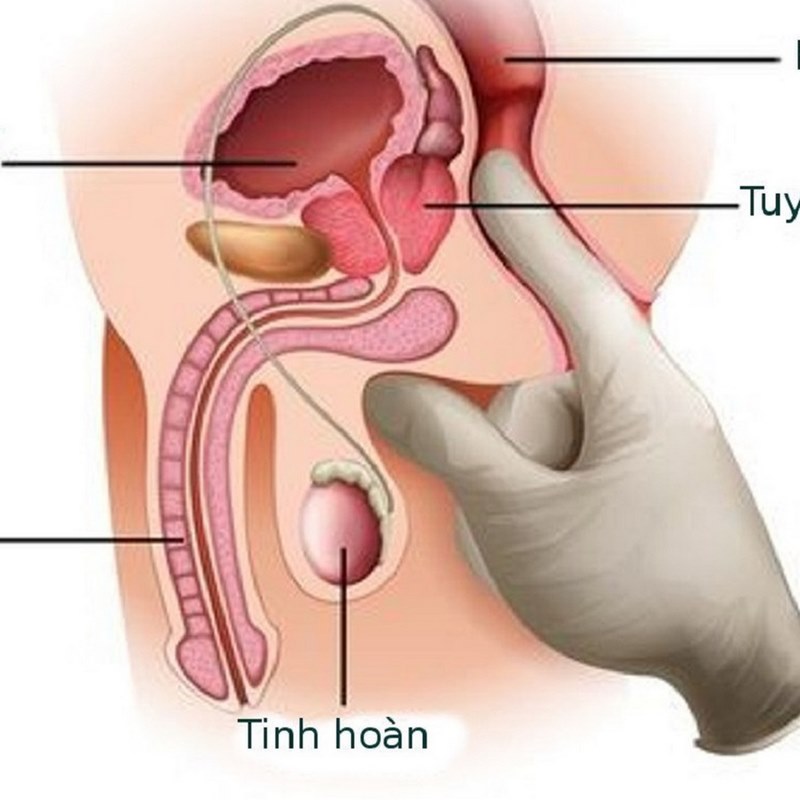 Bác sĩ có thể thực hiện kiểm tra cơ thể để tìm hiểu các dấu hiệu