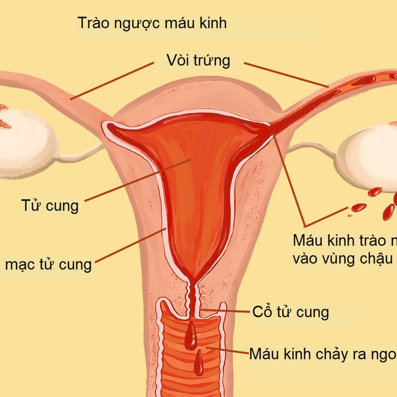 Phụ nữ trên 30 tuổi, đặc biệt là sau khi mãn kinh dễ mắc bệnh