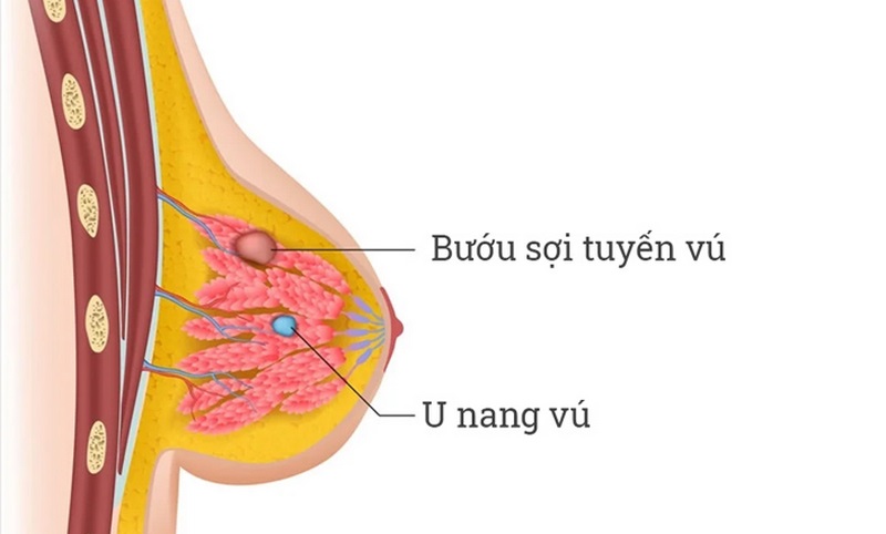 Cần kiểm tra định kỳ để phát hiện bệnh