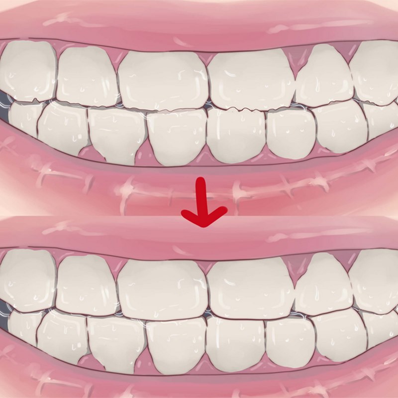 Tham khảo ý kiến của chuyên gia nha khoa để tìm phương pháp điều trị phù hợp