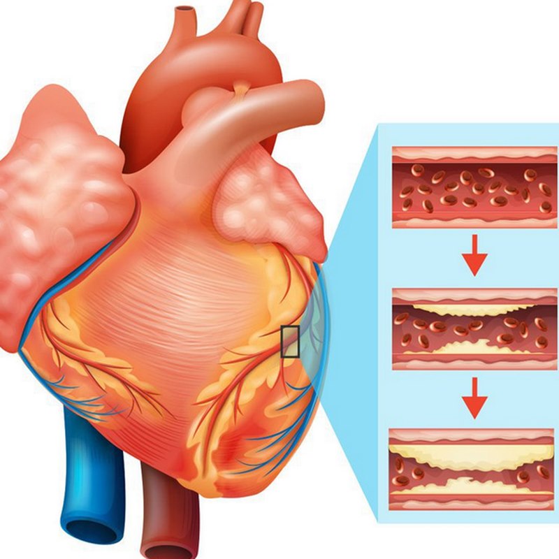 Người có lối sống không lành mạnh dễ mắc bệnh