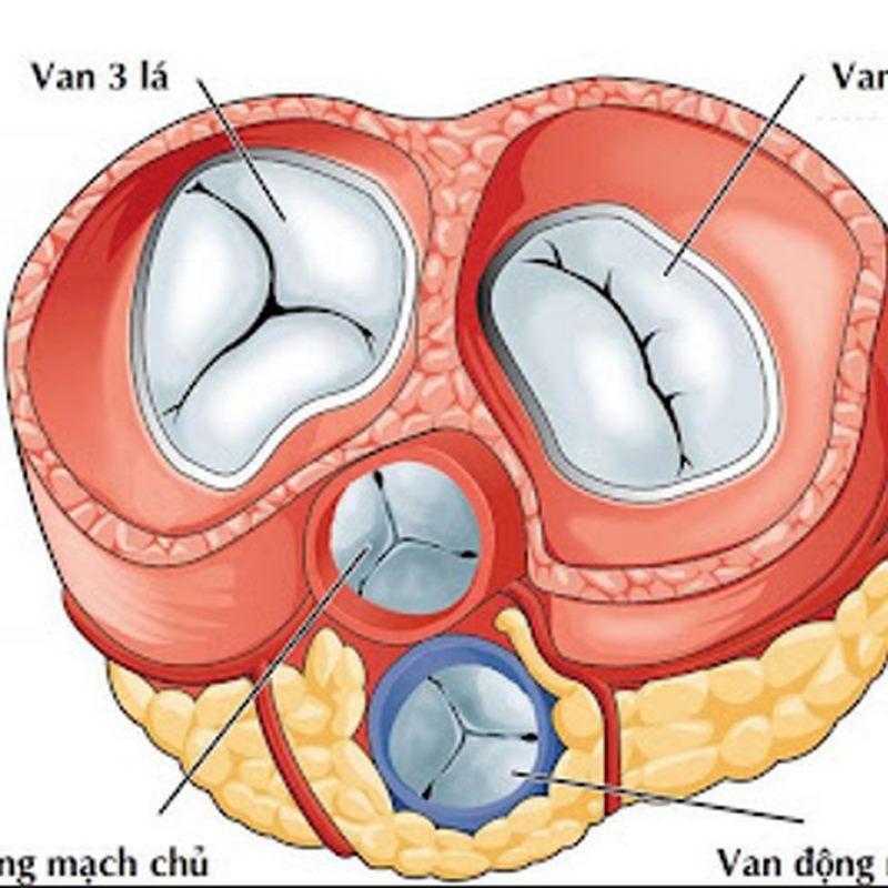 Người có tiền sử gia đình có người thân mắc bệnh van tim dễ có nguy cơ