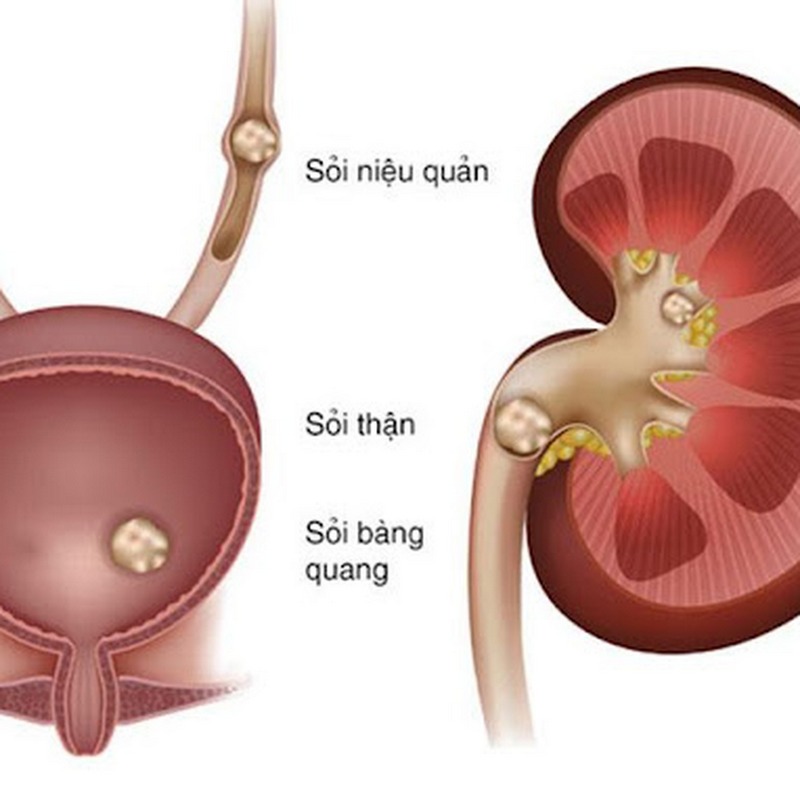 Một số bệnh như tiểu đường, viêm bàng quang gây đi tiểu nhiều