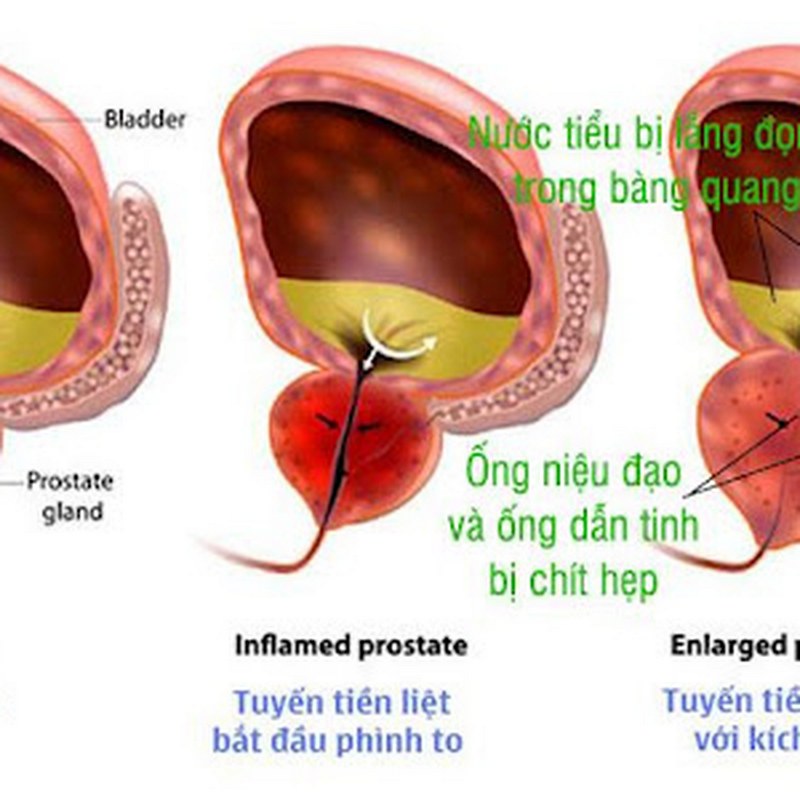 Nhớ luôn tuân thủ hướng dẫn từ bác sĩ và thực hiện đúng cách để đảm bảo sức khỏe của bạn