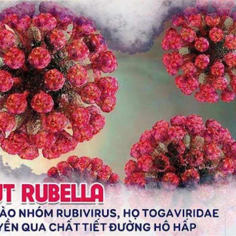 Một số dấu hiệu và triệu chứng của bệnh Rubella