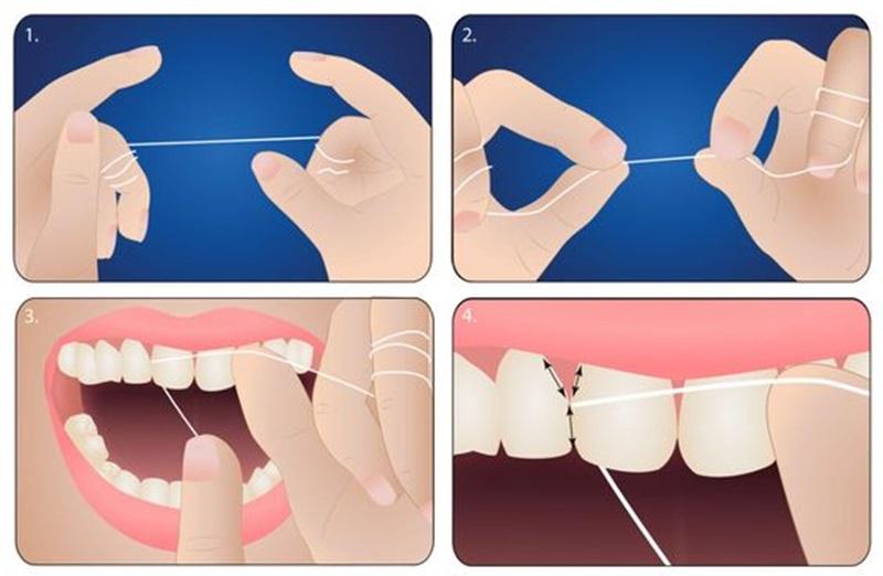 6 bước sử dụng chỉ nha khoa đúng cách