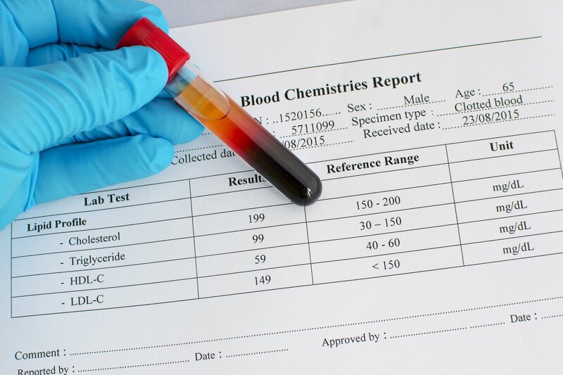 Cholesterol máu cao có thể do di truyền