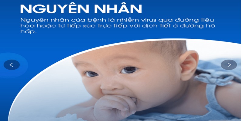 Bệnh tay, chân, miệng là một bệnh lây nhiễm do virus Enterovirus