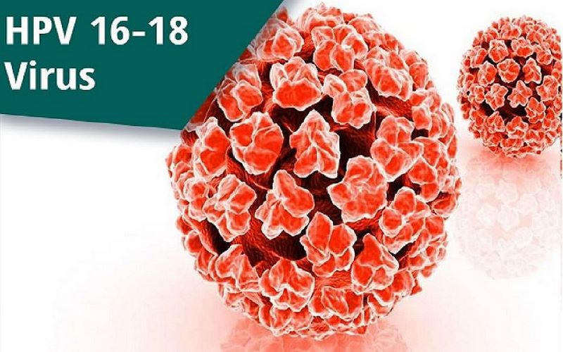 Người bệnh nhiễm phải virus HPV loại 16 và loại 18 có thể gây nên bệnh ung thư amidan