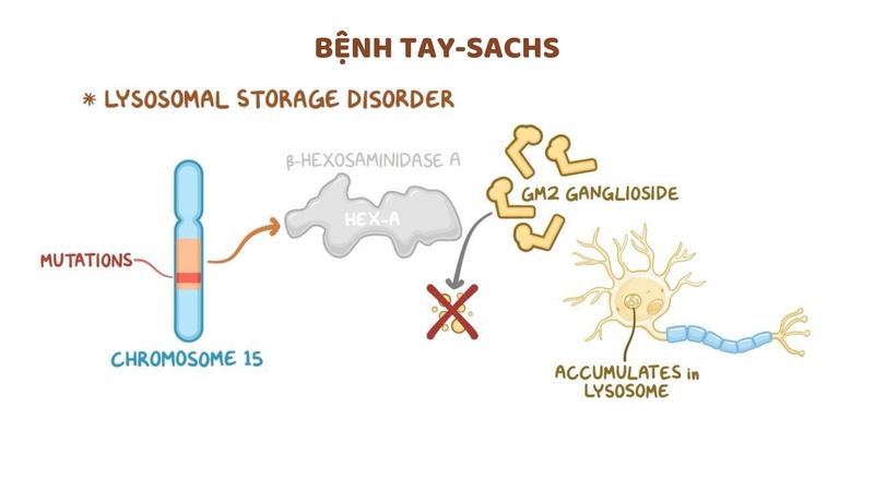 Đột biến gen HEXA trong bệnh Tay-Sachs