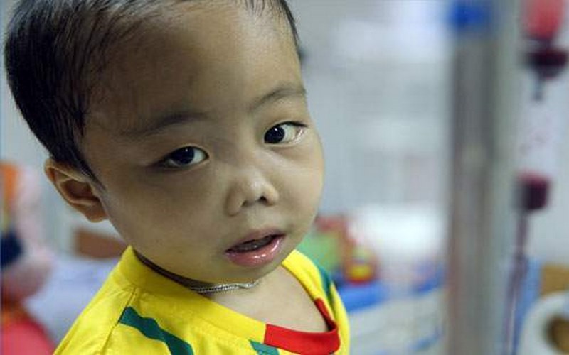 Trẻ bị Thassemia có biểu hiện xanh xao.