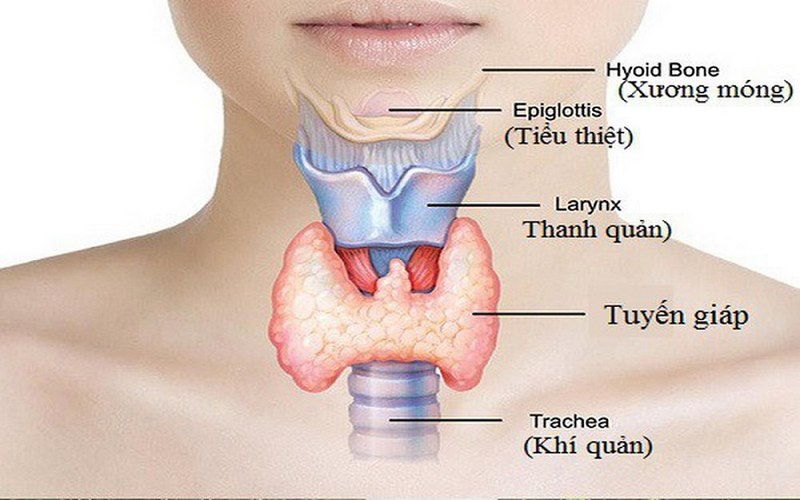 Người có tiền sử gia đình mắc bệnh bướu cổ cũng có thể bị di truyền