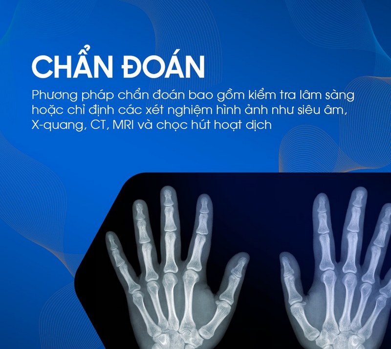 Phương pháp chuẩn đoán và điều trị bệnh