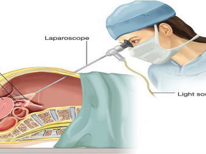 Bác sĩ sẽ hỏi về các triệu chứng bạn đang gặp phải