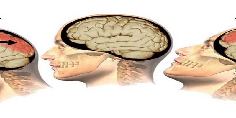 Các xét nghiệm hình ảnh như C.T scanner hoặc MRI