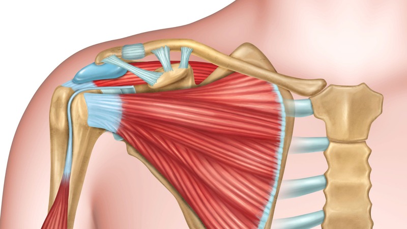 Nguyên nhân dẫn đến đau bả vai