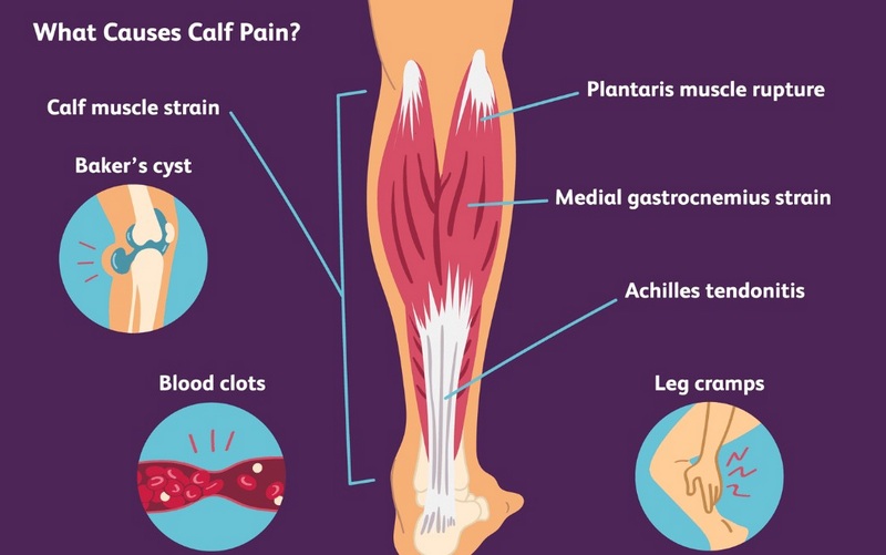 Tìm hiểu chung về tình trạng đau bắp chân