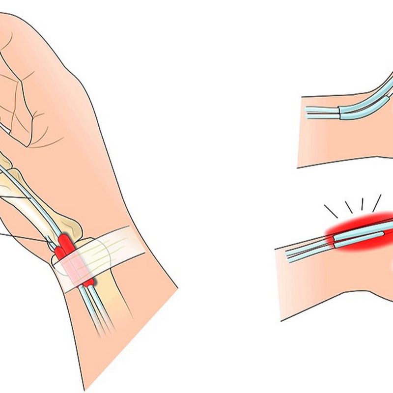 Phương pháp chuẩn đoán và điều trị bệnh