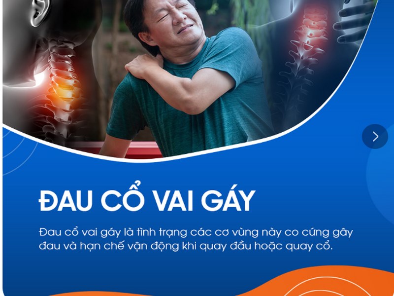 Đau cổ vai gáy là gì?