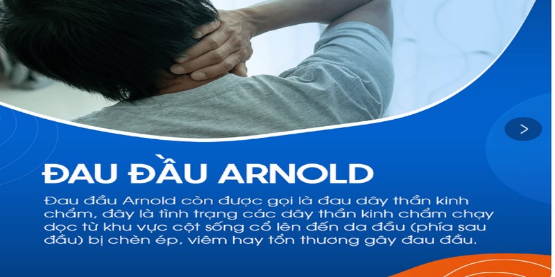 Đau đầu Arnold là gì?