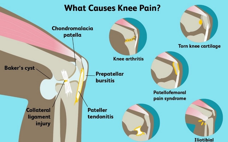 Để chuẩn đoán và điều trị đau đầu gối