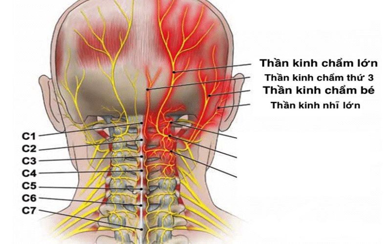 Vị trí của dây thần kinh chẩm.