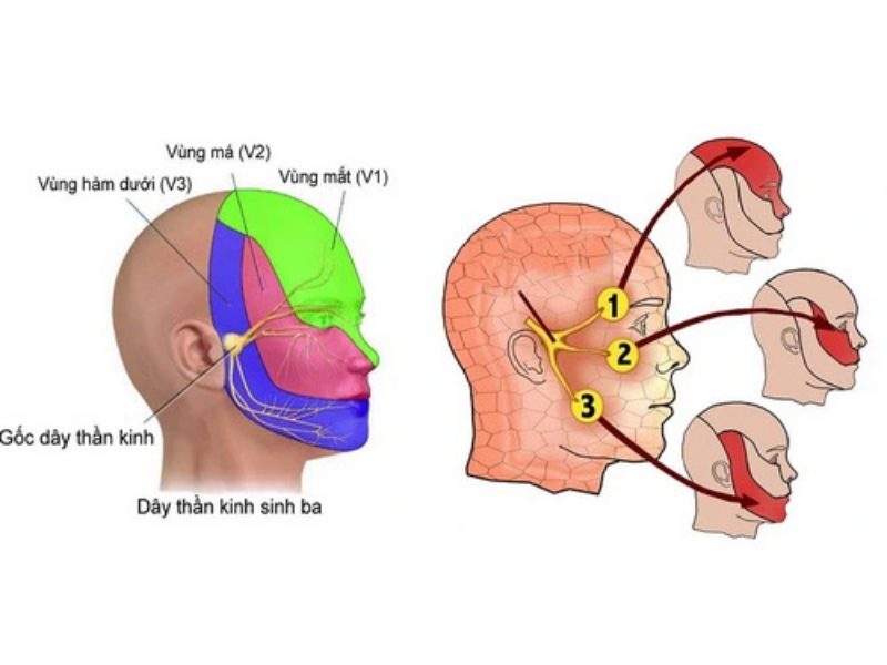 Hình ảnh giải phẫu dây thần kinh tam thoa.