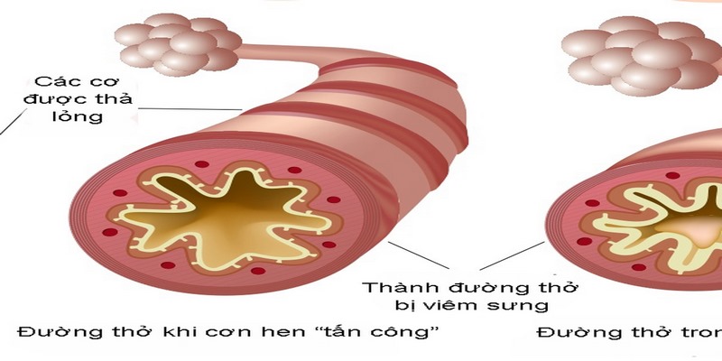 Các bệnh lý khác như viêm họng, viêm amidan