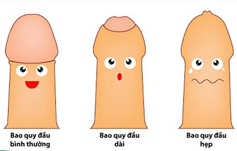 Tìm hiểu chung về hẹp bao quy đầu