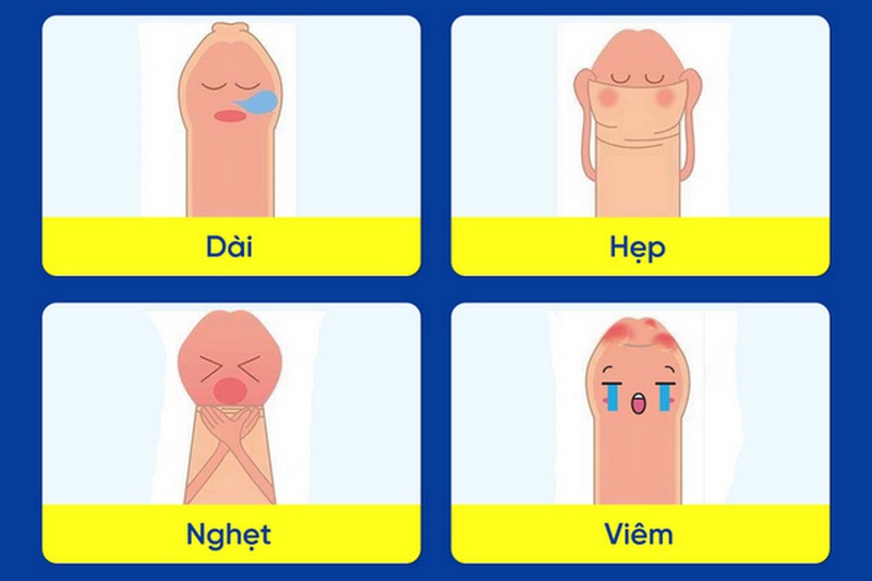 Phương pháp chuẩn đoán và xét nghiệm