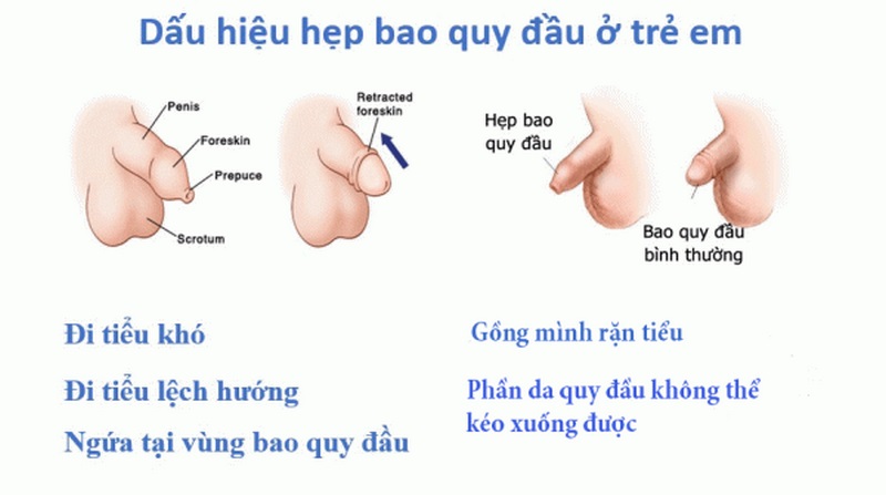 Chế độ sinh hoạt dành cho người bệnh