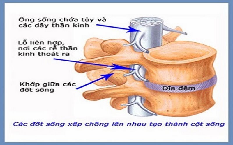 Cong vẹo cột sống có thể khiến bạn dễ bị hẹp lỗ liên hợp đốt sống cổ hơn