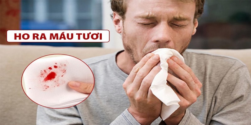 Hút thuốc lá và uống rượu có thể làm tăng nguy cơ ho ra máu