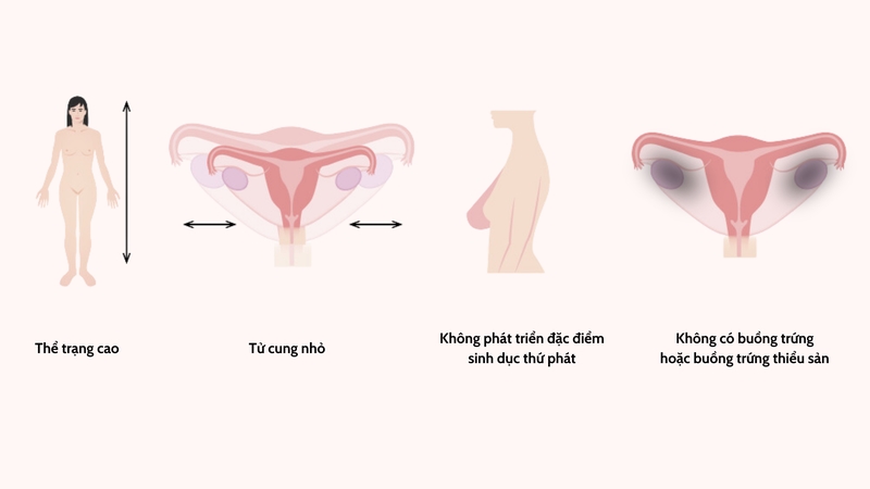 Các triệu chứng điển hình của hội chứng Swyer ở nữ