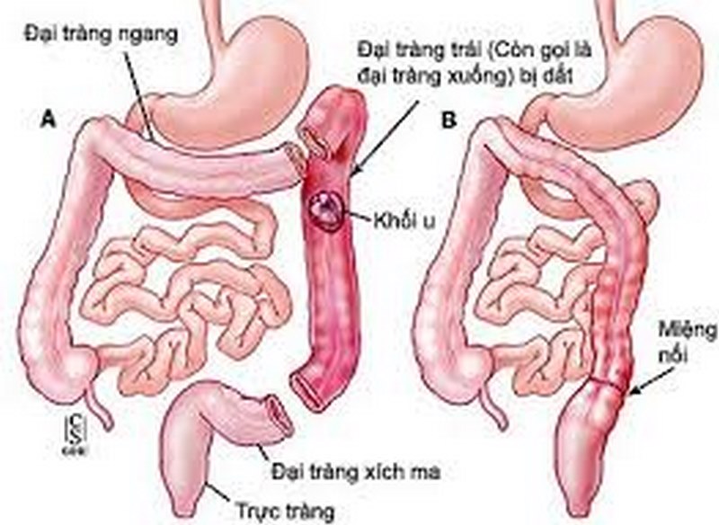 Bệnh có nhiều triệu chứng