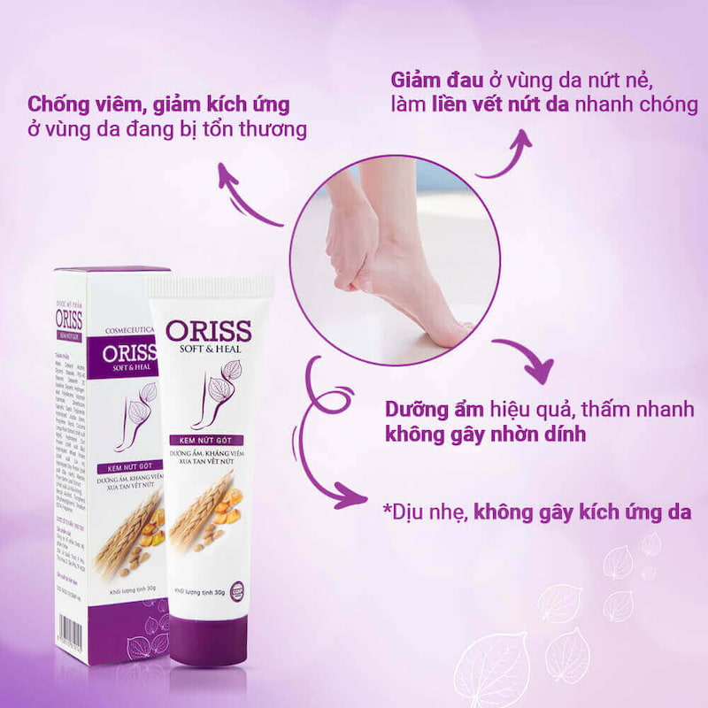 Kem dưỡng da chân hiệu quả hàng đầu Oriss