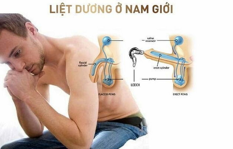 Nam giới trung niên dễ mắc bệnh